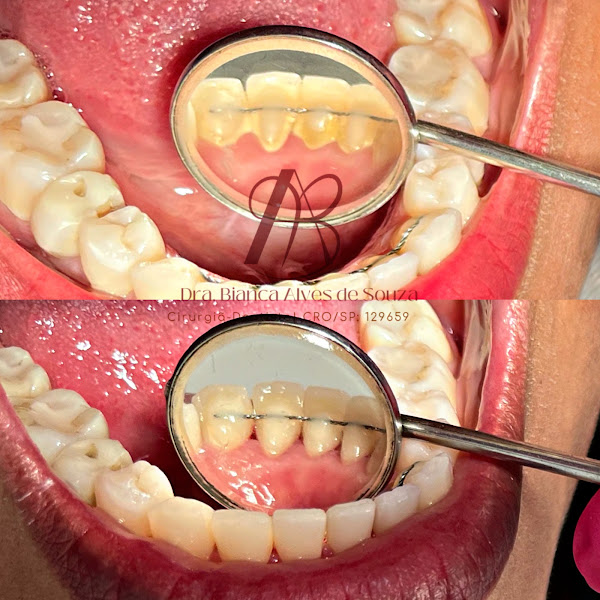 Foto 2 de Dra. Bianca A. Souza | Dentista em Franco da Rocha