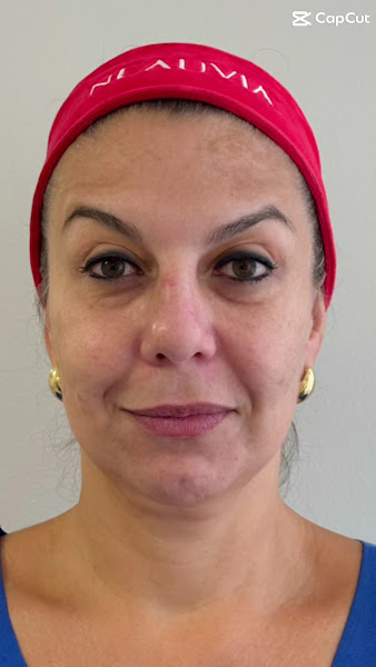 Foto 3 de Dra. Bianca Cardoso | Cirurgiã Dentista