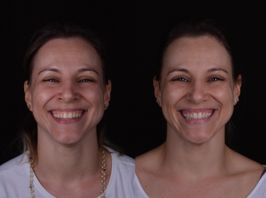 Foto 2 de Dra. Bianca Dias, Dentista