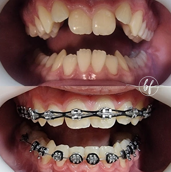 Foto 2 de Dra. Bianca Ferreira Machado – Dentista 24 horas em Piracicaba