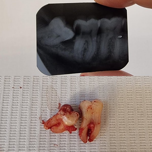 Foto 3 de Dra. Bianca Ferreira Machado – Dentista 24 horas em Piracicaba