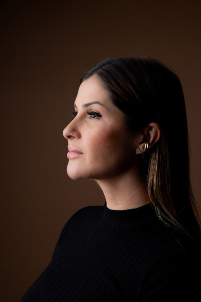 Foto 2 de Dra Bianca Jasmin - Preenchimento Labial | Ortodontia | Invisalign