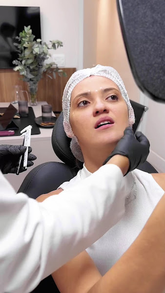 Foto 3 de Dra Bianca Jasmin - Preenchimento Labial | Ortodontia | Invisalign