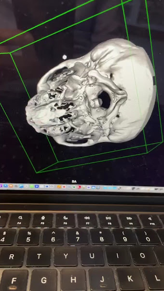 Foto 3 de Dra Bianca Leão - Dentista: Dor e DTM