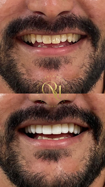 Foto 3 de Dra. Bianca Menezes | Harmonização Facial - Alphaville| SP