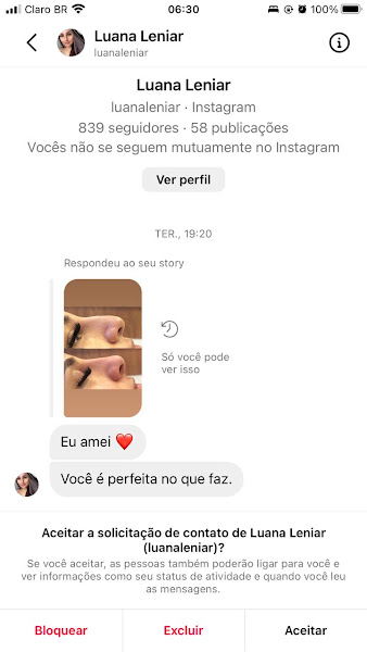 Foto 3 de Dra Bianca Oliveira - Harmonização Facial
