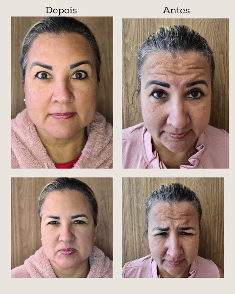 Foto 3 de Dra Bianca Paludo | Harmonização Facial e Ortodontia