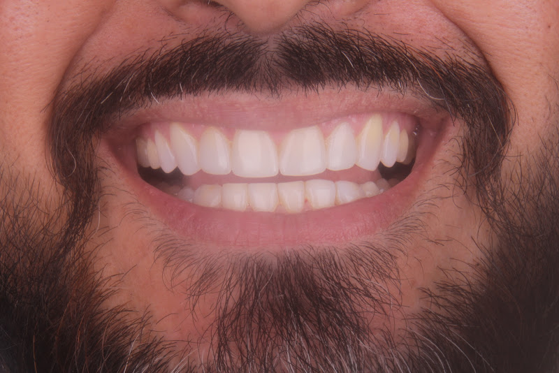 Foto 4 de Dra. Bianca Trajano - Invisalign Manaus