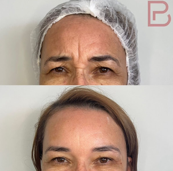 Foto 3 de Dra. Brena P. Araújo | Harmonização Facial - Arapiraca