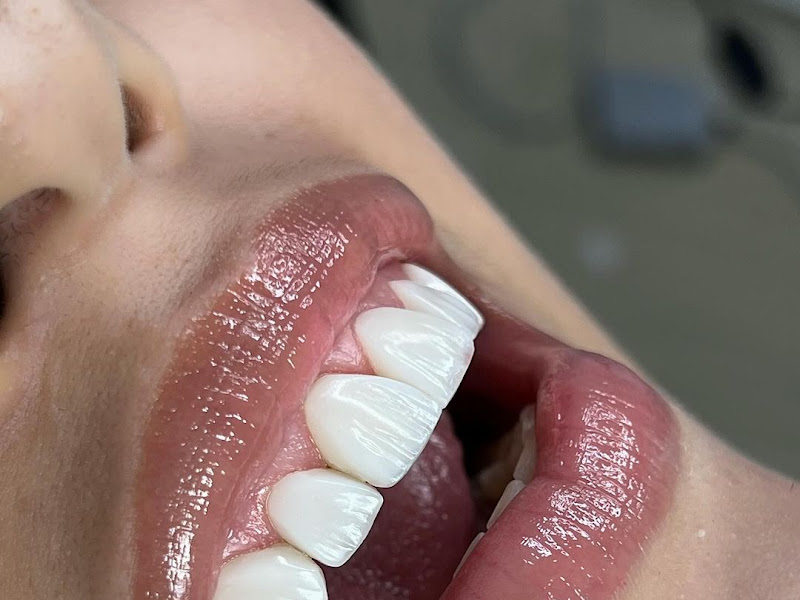 Foto 7 de Dra. Brenda Corrêa - Consultório Odontológico - DENTISTA ESPECIALISTA EM IMPLANTE DENTÁRIO EM ANANINDEUA