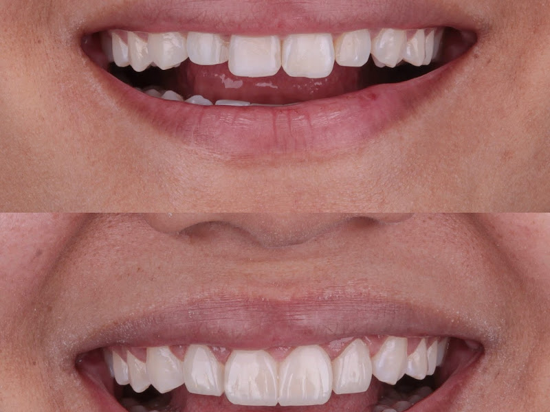 Foto 9 de Dra. Brenda Corrêa - Consultório Odontológico - DENTISTA ESPECIALISTA EM IMPLANTE DENTÁRIO EM ANANINDEUA