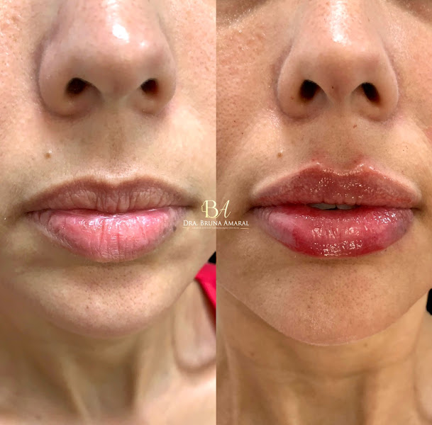 Foto de Dra Bruna Amaral | Especialista em Harmonização Orofacial | Camarota Centro de saúde.