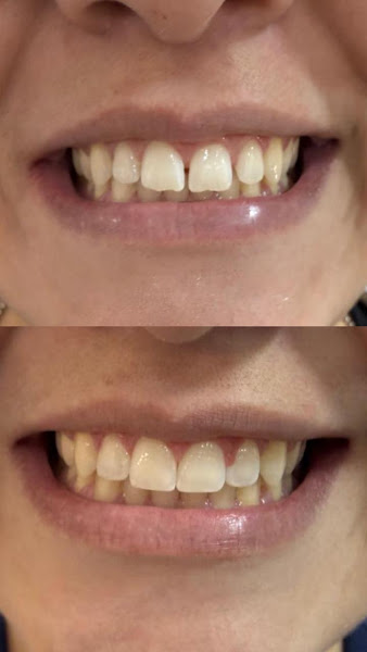 Foto 3 de Dra Bruna Bizarria Markiz - Dentista Vila Carrão