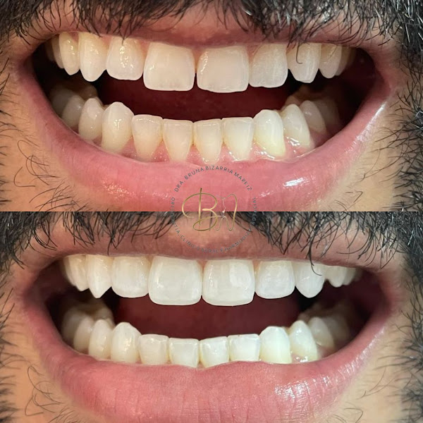 Foto 4 de Dra Bruna Bizarria Markiz - Dentista Vila Carrão