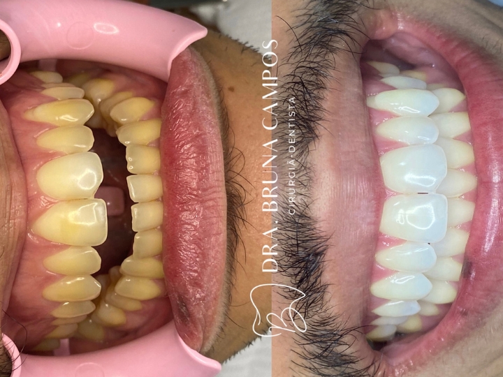 Foto 3 de Dra. Bruna Campos | Dentista em Duque de Caxias