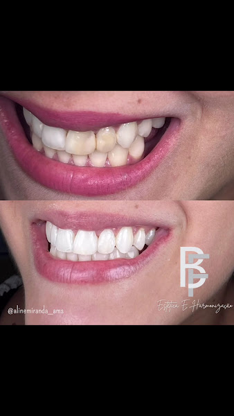 Foto 4 de Dra. Bruna Fagundes Dentista