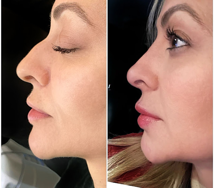 Foto 3 de Dra. Bruna Fameli