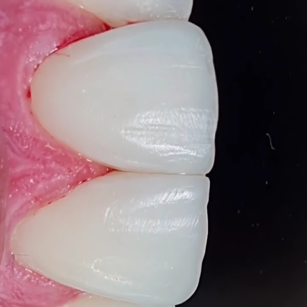 Foto 5 de Dra. Bruna Gimenes