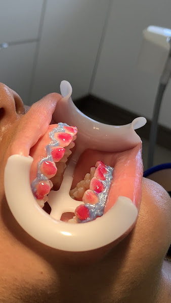 Foto 2 de Dra Bruna Gonçalves - Dentista em pinda