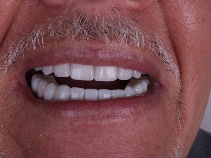 Foto de Dra Bruna Lemos- Odontologia Estética em Franca/SP- Implantes e Lentes de contato dental.