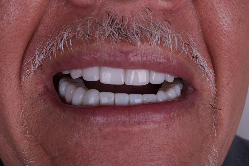 Foto 2 de Dra Bruna Lemos- Odontologia Estética em Franca/SP- Implantes e Lentes de contato dental.