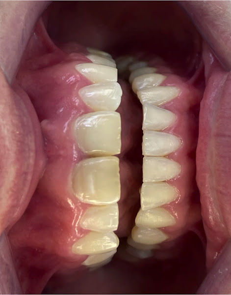 Foto 2 de Dra. Bruna Levandoski Odontologia