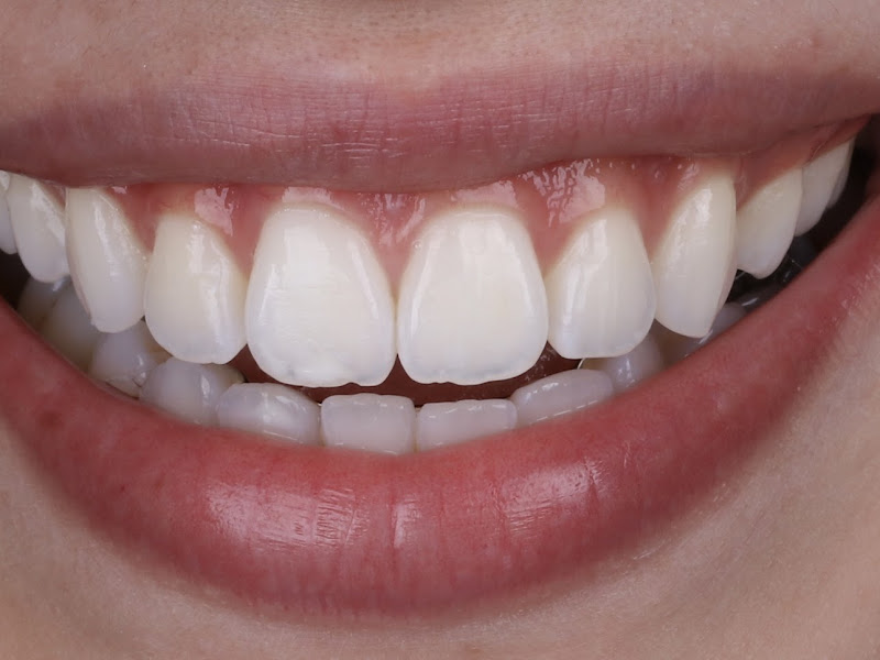 Foto 3 de Dra Bruna Marcela Demogalski Dombeck