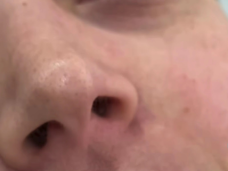 Foto de Dra. Bruna Marques | Harmonização Facial | Cascavel