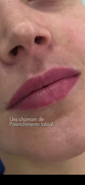 Foto 2 de Dra. Bruna Marques | Harmonização Facial | Cascavel