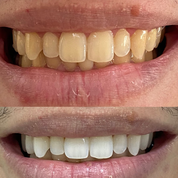 Foto 2 de Dra. Bruna Novaes Mendes Rossini, Prótese e Estética Dentária