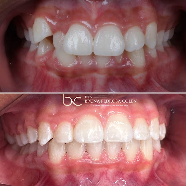 Foto 3 de Dra. Bruna Pedrosa Colen - Dentista Teófilo Otoni