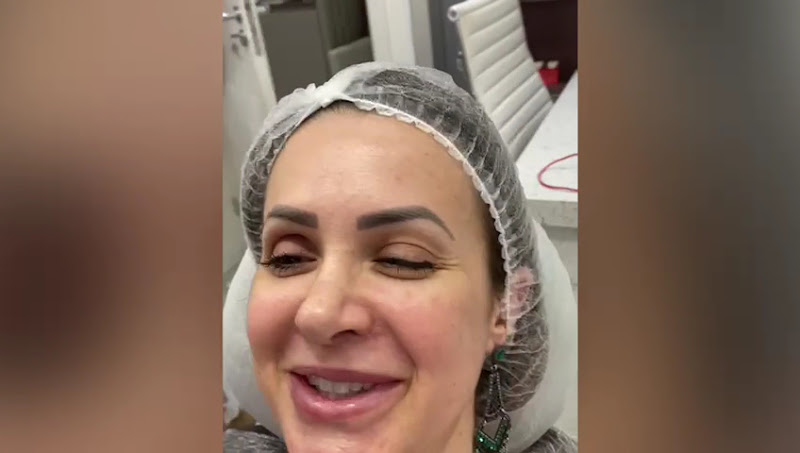 Foto 3 de Dra. Bruna Pennacchi - Estética no Batel