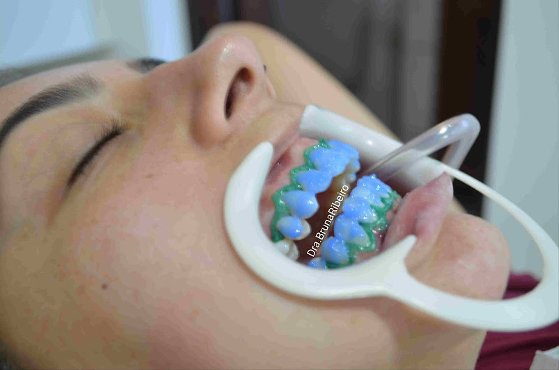 Foto 3 de Dra. Bruna Ribeiro