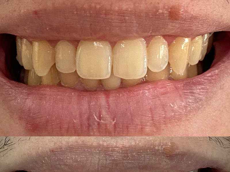 Foto 2 de Dra. Bruna Santarsiere Cruz - Clínica Odontológica Santarsiere Saúde