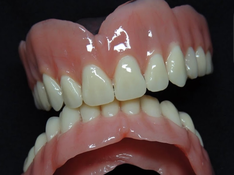 Foto 7 de Dra Bruna Soares - Dentista em São Luís - Clareamento Dental