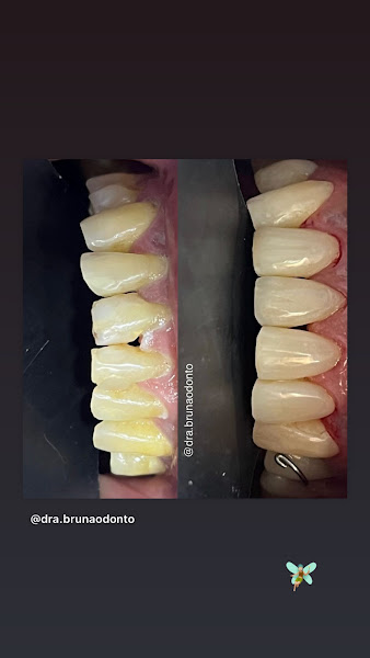 Foto 3 de Dra Bruna Souza - Cirurgiã-dentista