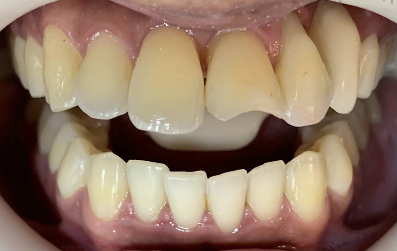 Foto 2 de Dra Brunet Odontologia & Harmonização Orofacial