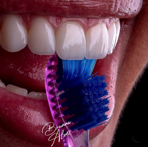 Foto 3 de Dra Brunna Alves Dentista