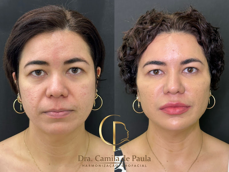 Foto de Dra. Camila de Paula - Harmonização Orofacial