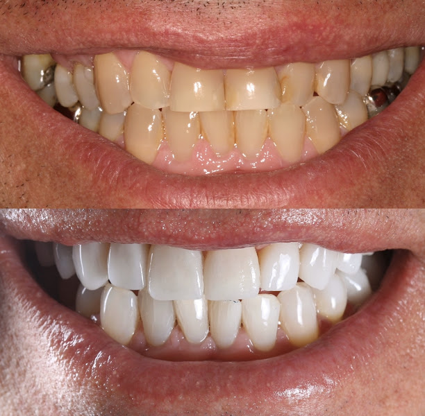 Foto 3 de Dra. Camila Freitas - Implantes Dentários em Feira de Santana - BA