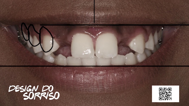 Foto 5 de Dra. Camila Freitas - Implantes Dentários em Feira de Santana - BA