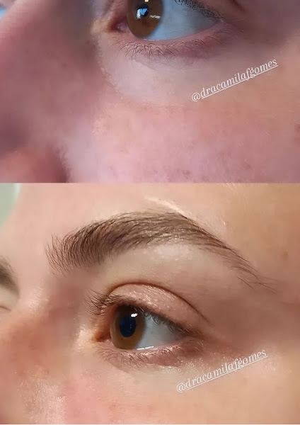 Foto 2 de Dra Camila Gomes Harmonização facial