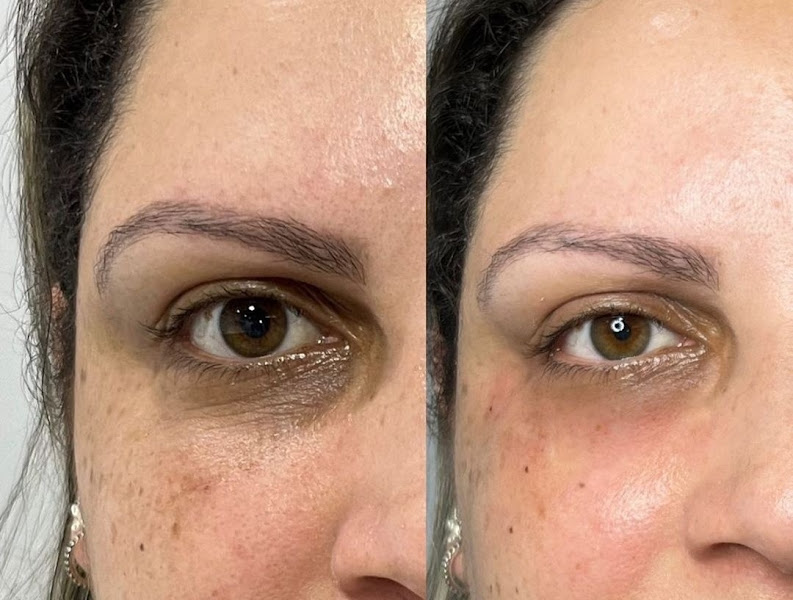 Foto 3 de Dra Camila Gomes Harmonização facial