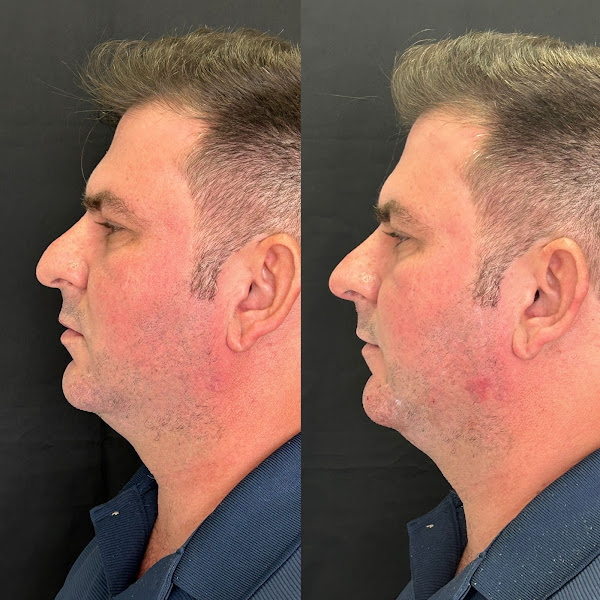 Foto 2 de Dra. Camila Larissa Avila | Harmonização Facial e Corporal na Vila da Penha-RJ