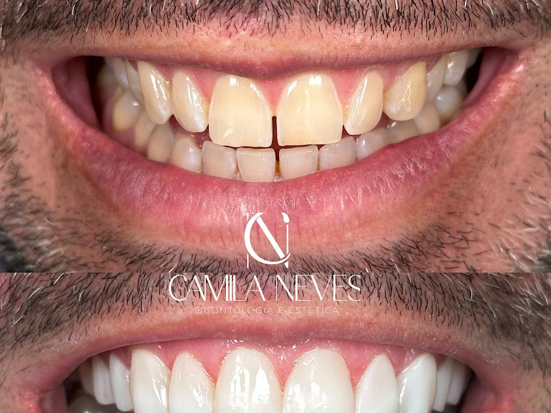 Foto 3 de Dra Camila Larsen Ciorlia - Dentista/Endodontia