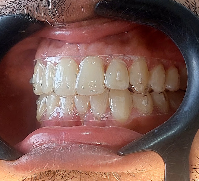 Foto 3 de Dra Camila Marchezani | Dentista | Aparelho Invisível | Estética Dental | Implante