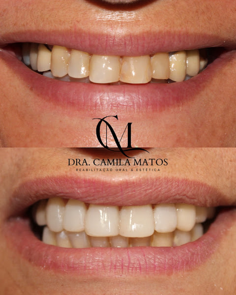 Foto 4 de Dra. Camila Matos Reabilitação Oral & Estética