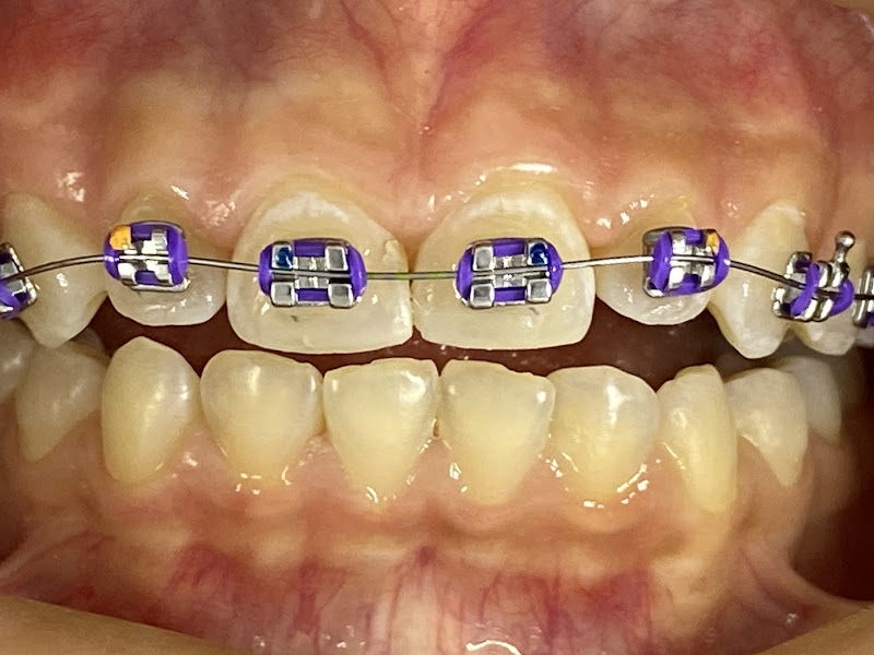 Foto 3 de Dra Camila Miguéis / Dr.Dirceu Miguéis - CIODONTO