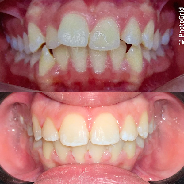 Foto 2 de Dra. Camila Pires | Aparelho e Clareamento em Artur Alvim