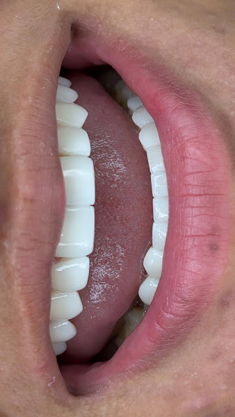 Foto 3 de Dra. Camila Santiago l Lentes em Resina ABC